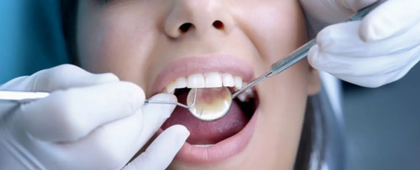 Basic Denture Care